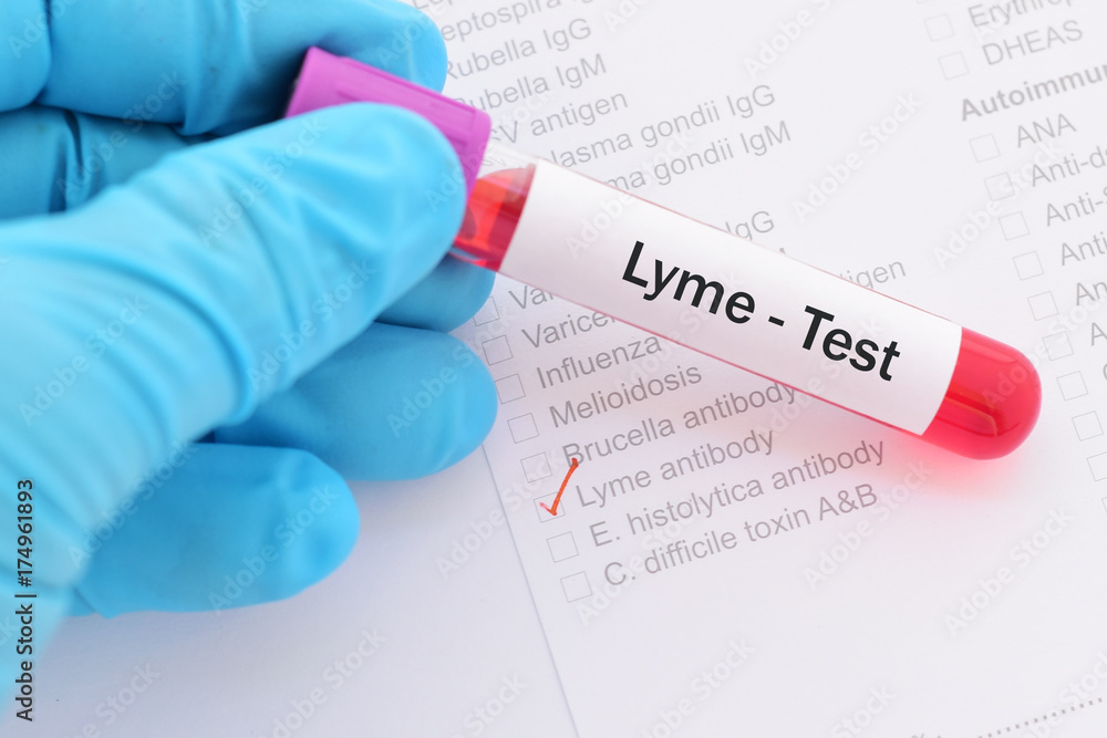 Lyme Literate Doctor